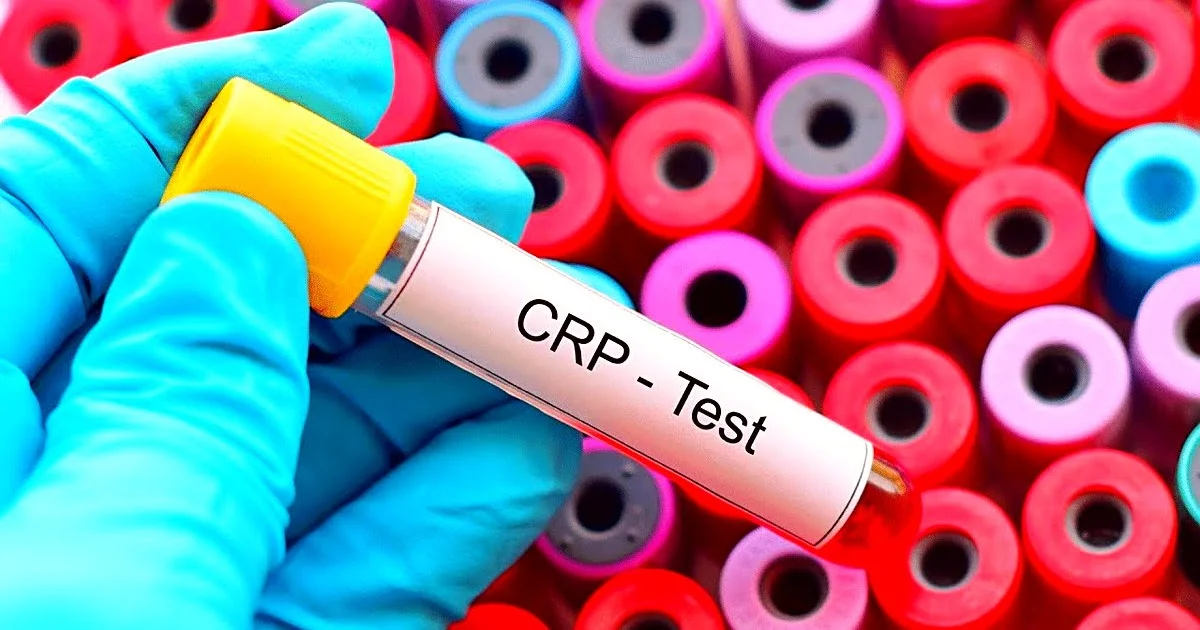 CRP və EÇS: Hansı Fərq Var?